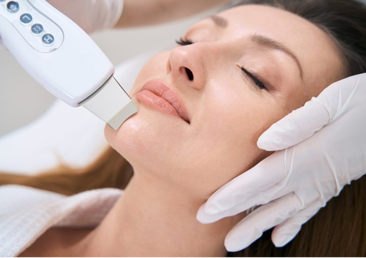 Mezoporācija + ultraskaņas pīlings 10 reizes