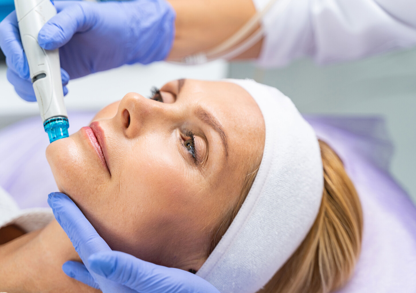 Dimanta mikrodermabrāzijas procedūra sejai un maska (3 seansi)