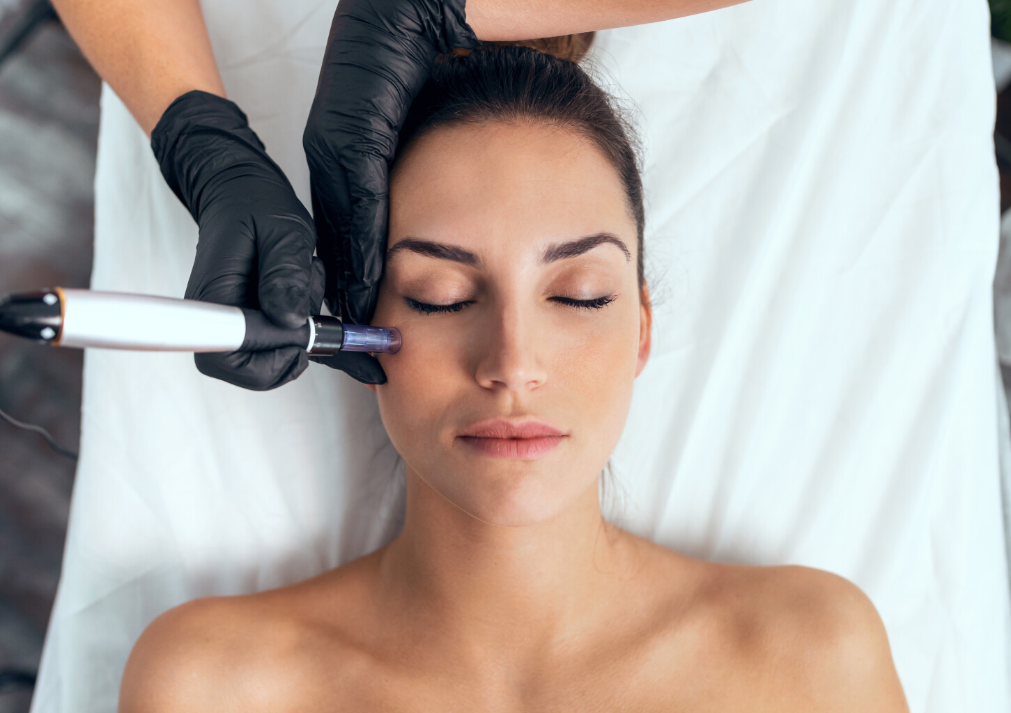 Bezinjekciju mezoterapija + dimantu pīlings sejai, kaklam un dekoltē zonai