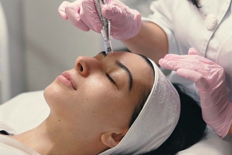 Микронидлинг для лица, шеи и декольте + пилинг в подарок